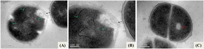 Effect of nanoemulsion loaded with macela (Achyrocline satureioides) on the ultrastructure of Staphylococcus aureus and the modulating activity of antibiotics